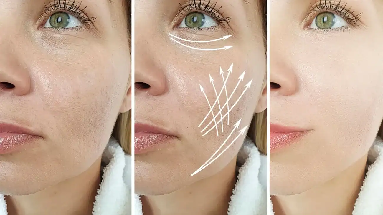 Can One Treatment Really Tackle More Than One Skin Concern Amersham?