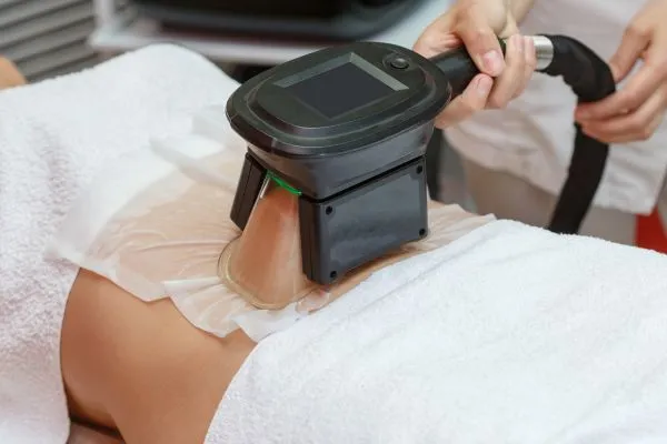 Image of person having fat freezing treatment to help weight gain Amersham