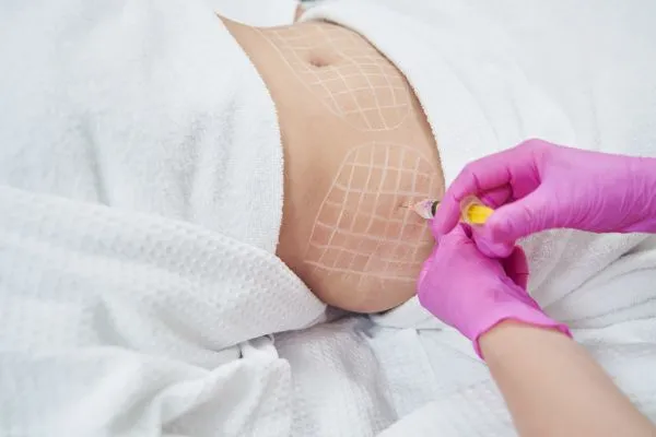 image of fat dissolving injections on love handles to help combat weight gain Amersham