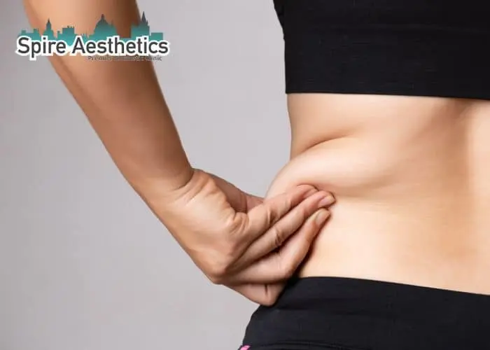 Image of woman pinching fat on their hips Amersham. Fat Freezing treatment