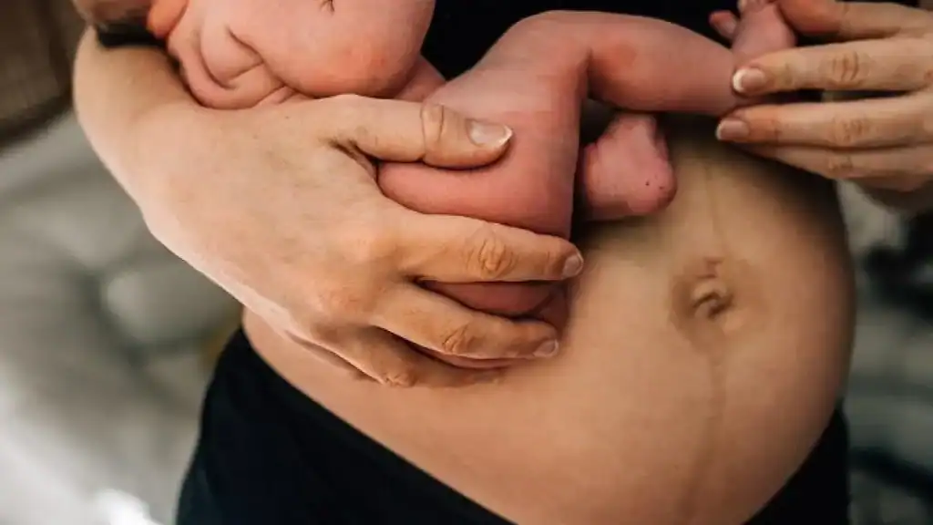 Why Is My Stomach Still Big After Pregnancy Amersham?